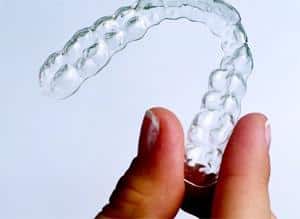 invisalign-2