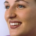 Invisalign3