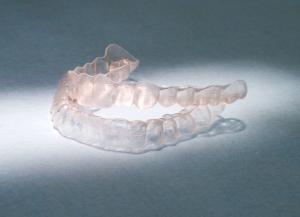 Herausnehmbare Plastikschienen als Retainer