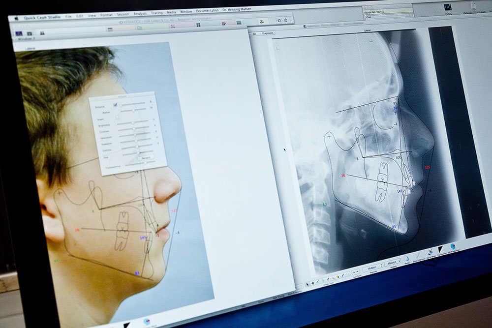 Behandlungsplanung mit QuickCeph