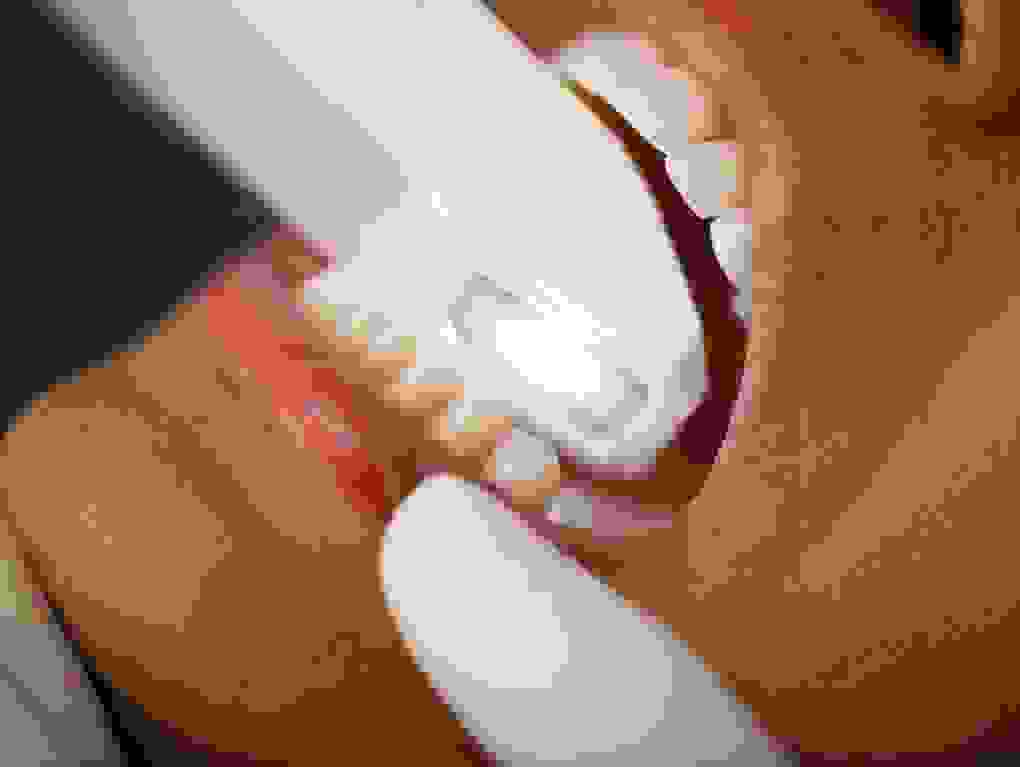 Scannen der Zähne und Kiefer mit dem itero-Scanner