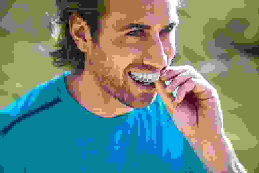 invisalign einsetzen
