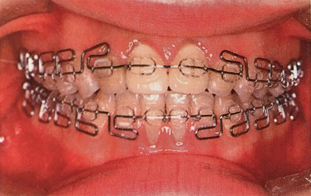 Multiloop Kieferorthopädie Dr. Madsen