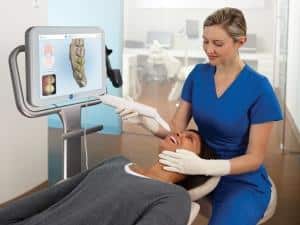 Faszinierende Technik: Invisaligns iTero-Scanner