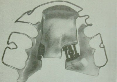 active upper-jaw plate