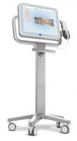 itero-scanner Der iTero Scanner: unser Einstieg in die digitale Kieferorthopädie